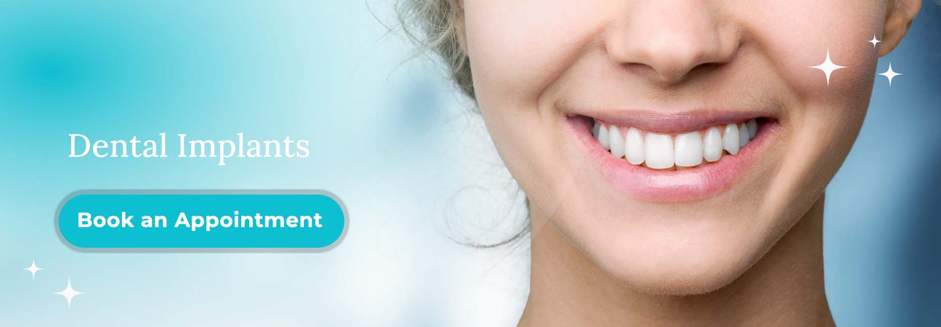 Dental implants Miami