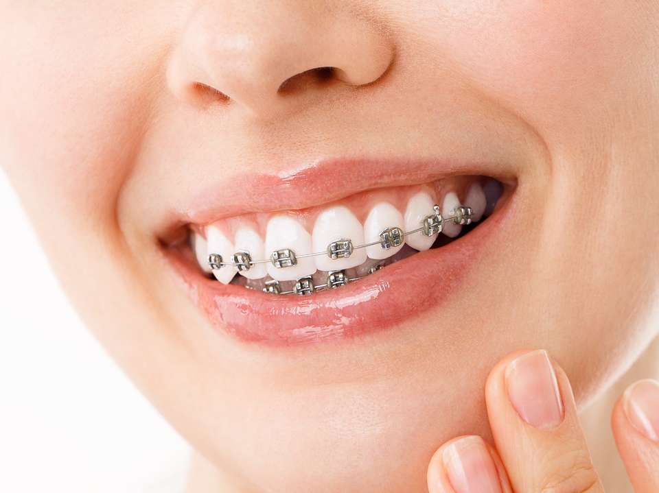 Orthodontics