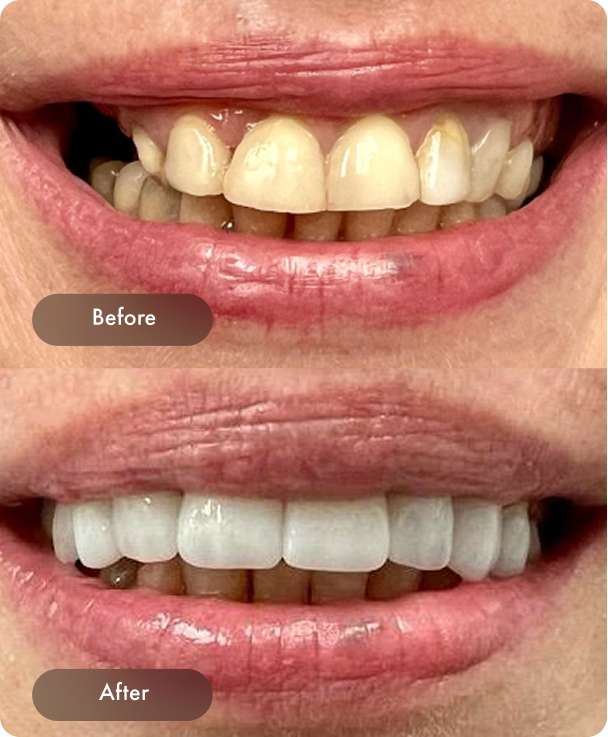 Dental Pearl Miami Before And After Case 3